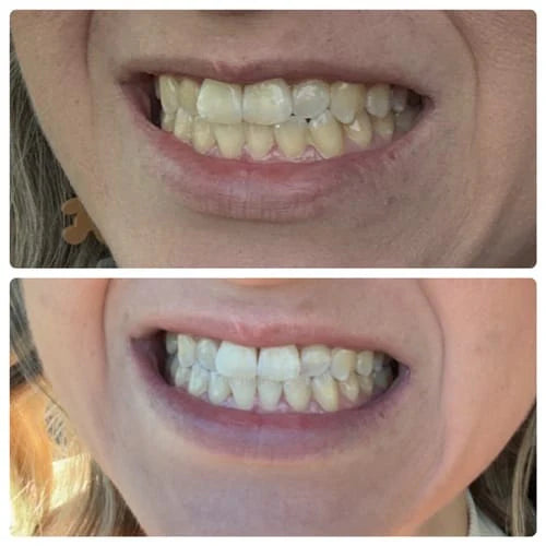 Smile BOXX Whitening Pen
